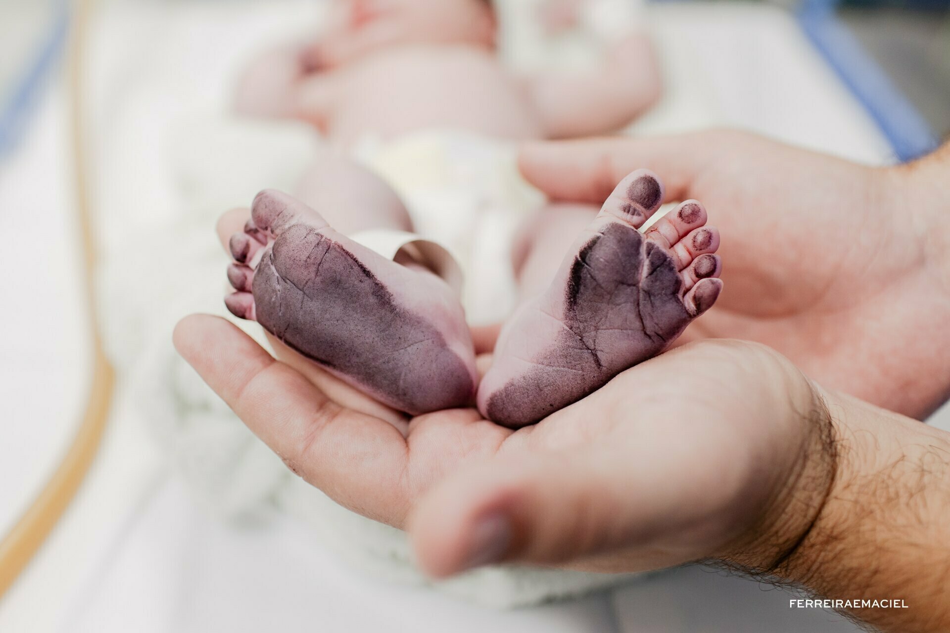 Fotografia de Parto no Hospital Unimed Criciúma - Fotos de nascimento em Araranguá - Criciúma - Turvo - Sombrio - Meleiro - Parto da Isadora - Mamãe Mariana e Papai Adrian