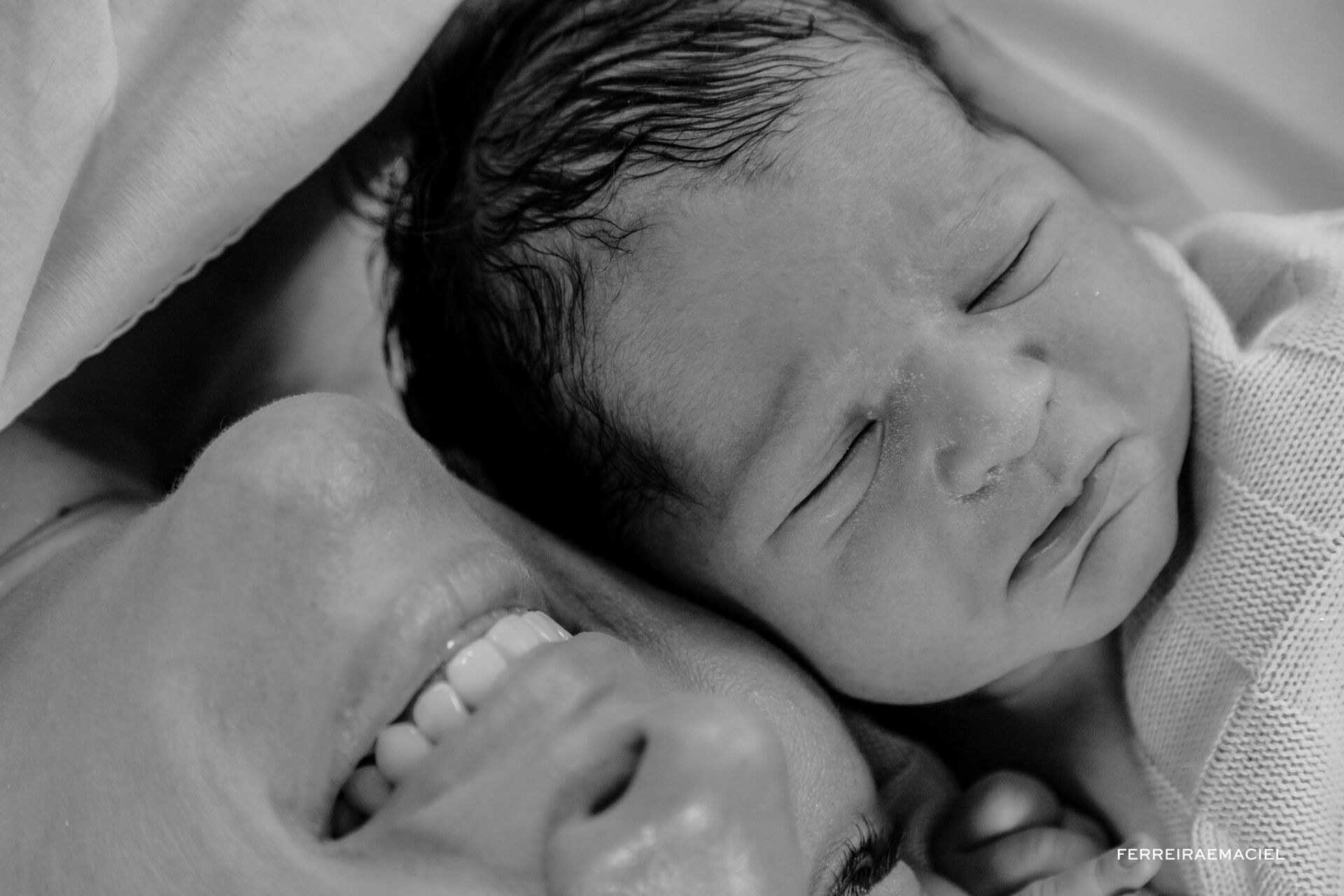 Foto Nascimento – Parto - Cesária-  Mariana Nuemberg – Hospital Unimed – Criciúma - SC - Imagem 31