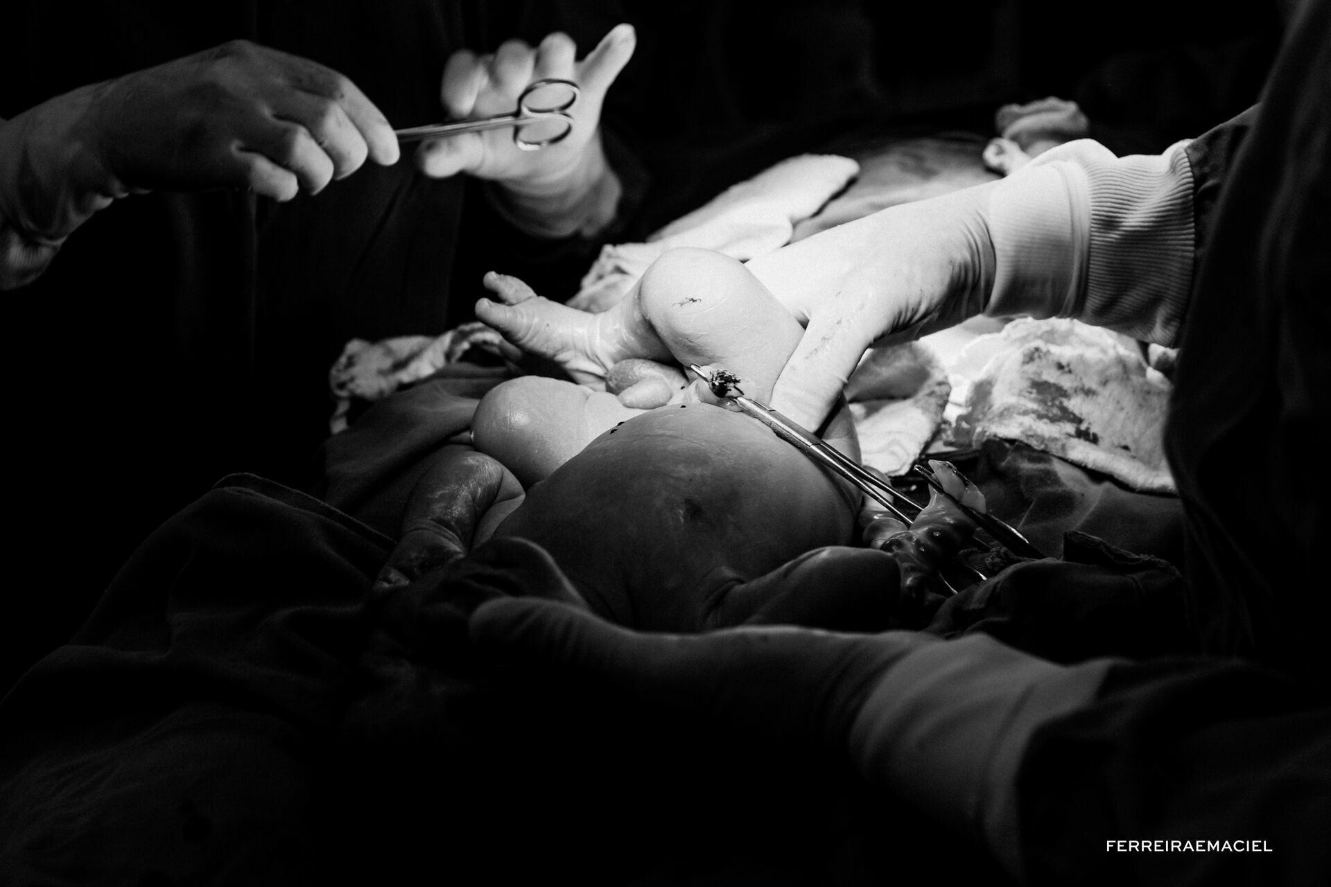 Foto Nascimento – Parto - Cesária-  Mariana Nuemberg – Hospital Unimed – Criciúma - SC - Imagem 12