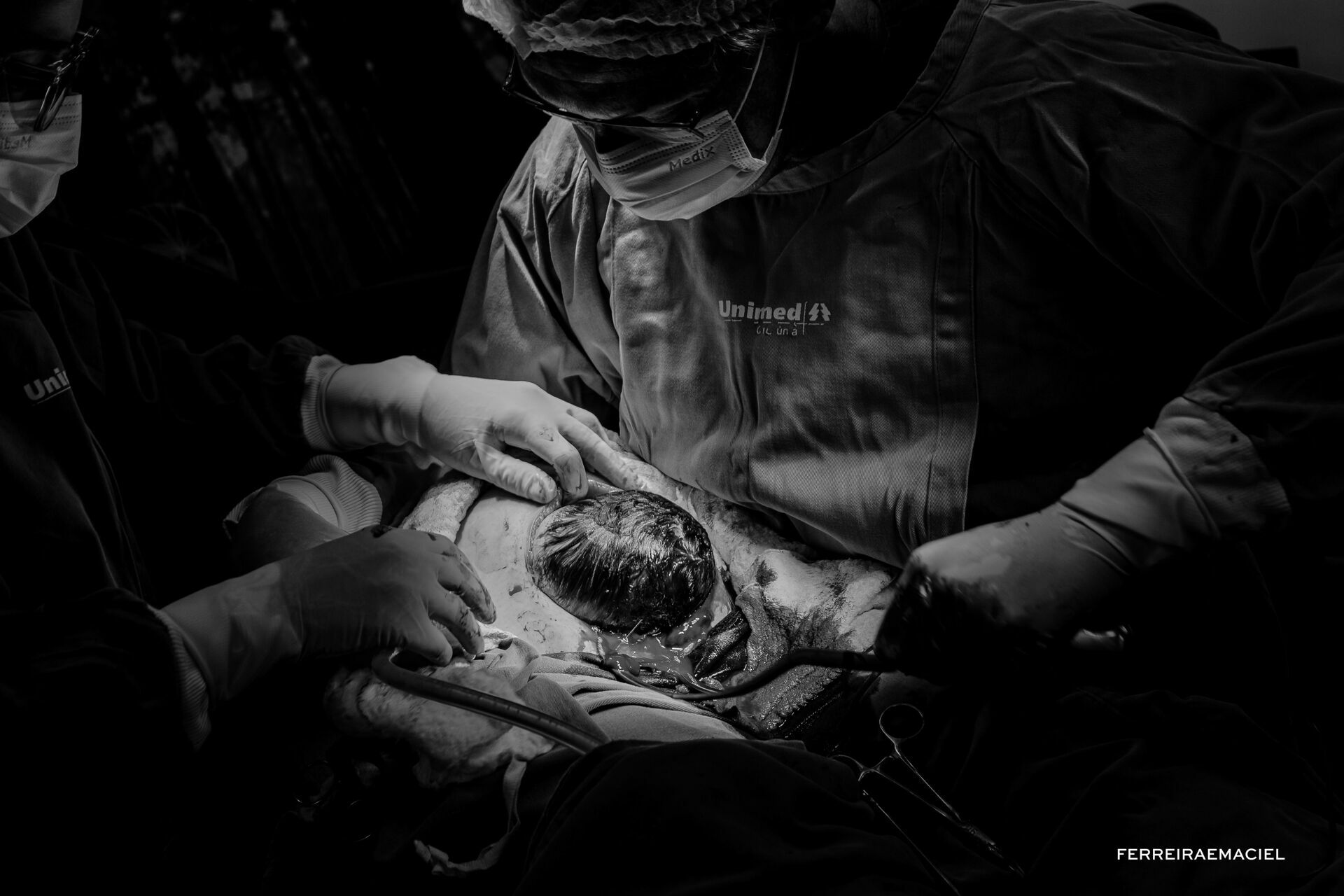 Foto Nascimento – Parto - Cesária-  Mariana Nuemberg – Hospital Unimed – Criciúma - SC - Imagem 8