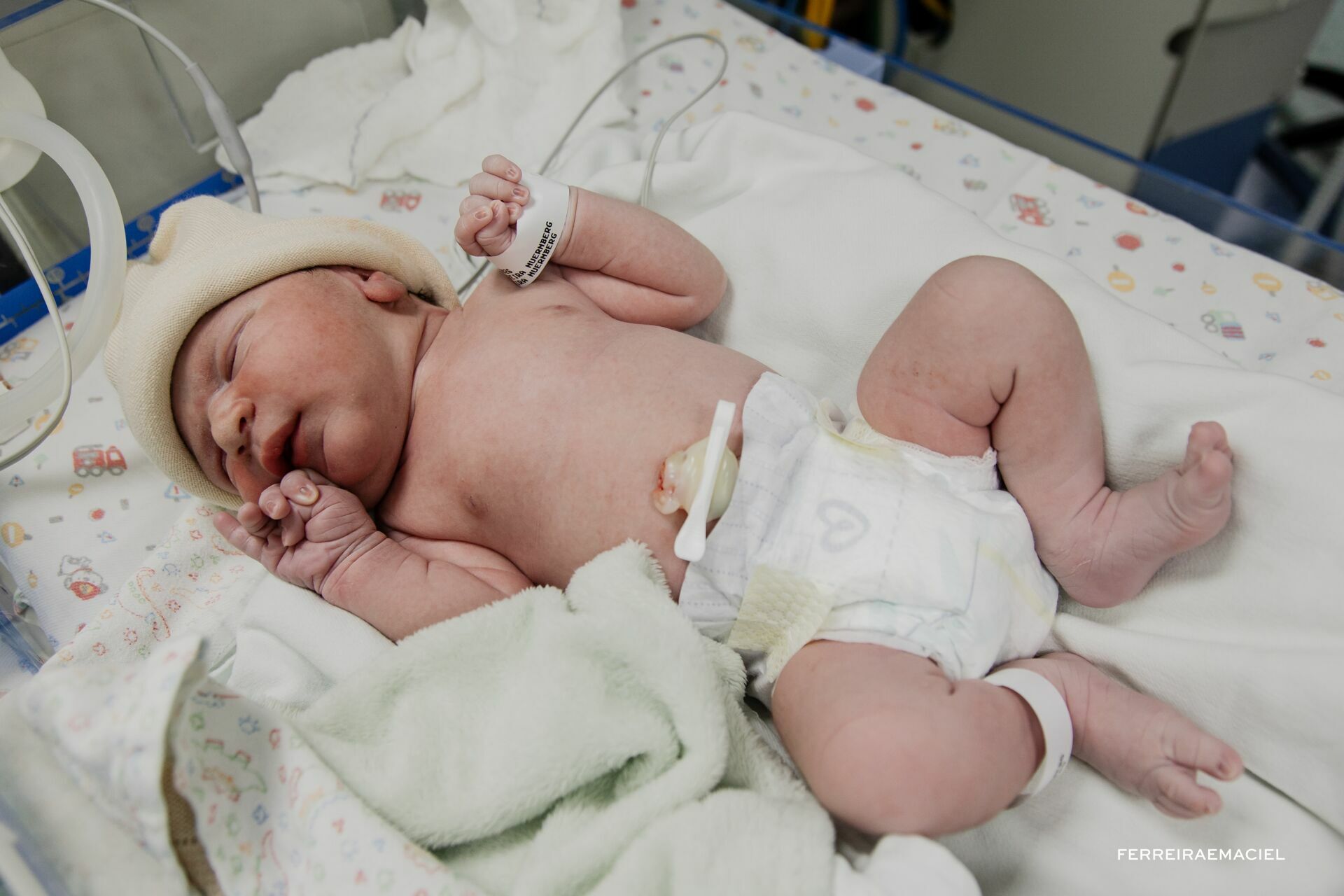 Foto Nascimento – Parto - Cesária-  Mariana Nuemberg – Hospital Unimed – Criciúma - SC - Imagem 24