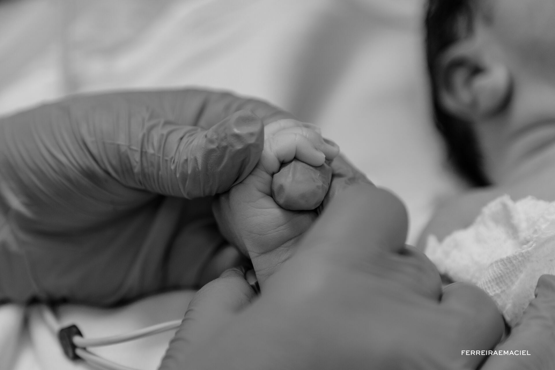 Foto Nascimento – Parto - Cesária-  Mariana Nuemberg – Hospital Unimed – Criciúma - SC - Imagem 16