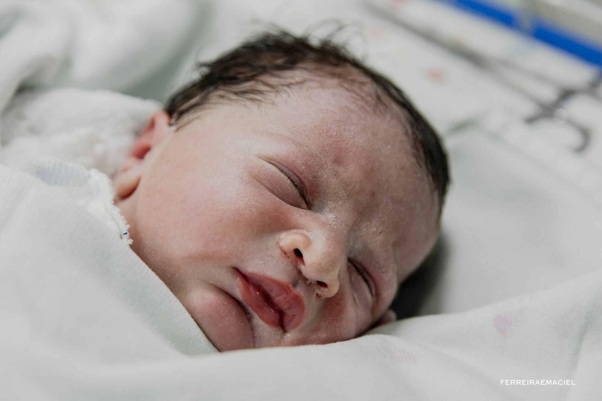 Foto Nascimento – Parto - Cesária-  Mariana Nuemberg – Hospital Unimed – Criciúma - SC - Imagem 14