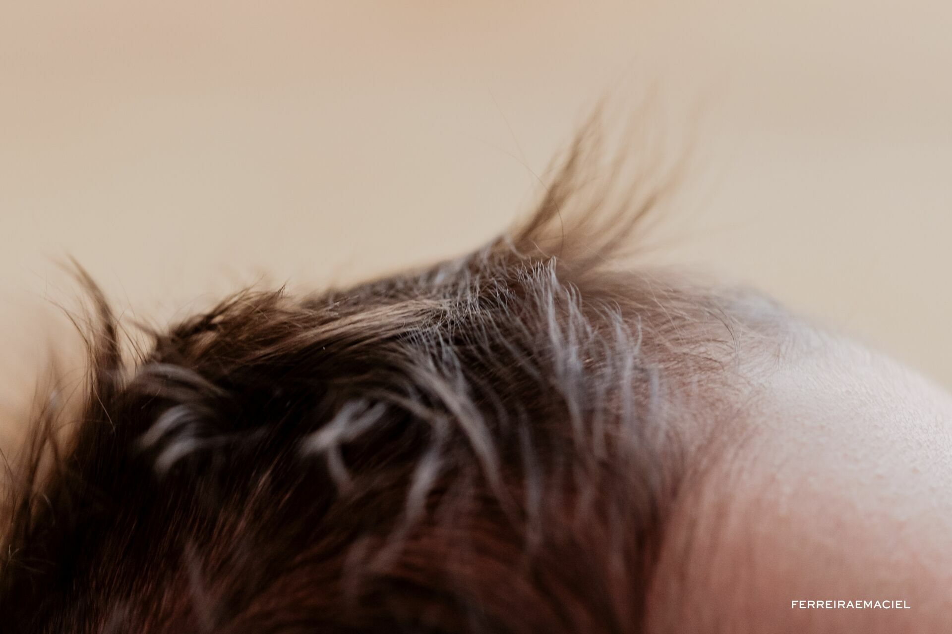 Foto Ensaio Newborn em Estúdio – Otto – Filho de Mariana Nuemberg - Fotografia de Recém-Nascido - Araranguá - Criciúma - Sombrio - Turvo - Ermo – SC Foto Ensaio Newborn em Estúdio – Otto – Filho de Mariana Nuemberg - Fotografia de Recém-Nascido - Araranguá - Criciúma - Sombrio - Turvo - Ermo – SC - Imagem 9